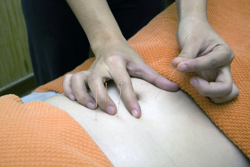 osteopathe-UTELLE-min_acupuncture-4175625